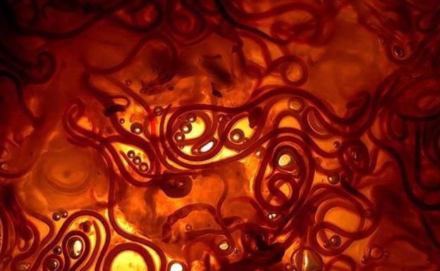 infección por parásitos giardia lamblia